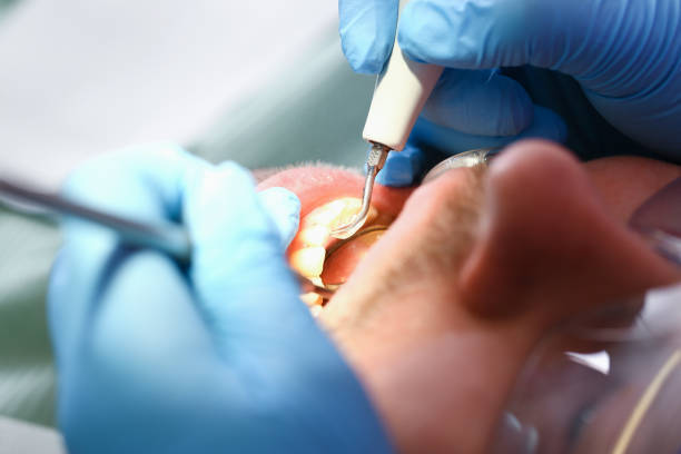 Best Emergency Care for Gum Disease in Timberville, VA