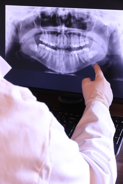 Best Knocked-Out Tooth (Avulsed Tooth) Treatment in Timberville, VA