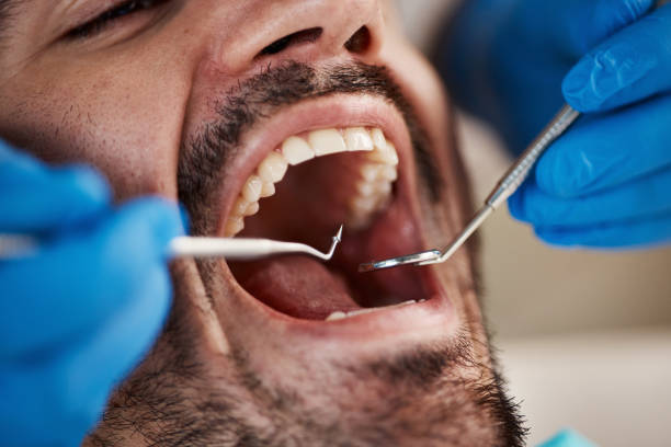 Best Dental Abscess Treatment in Timberville, VA