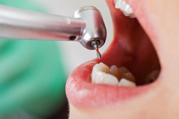 Best After-Hours Dental Care in Timberville, VA